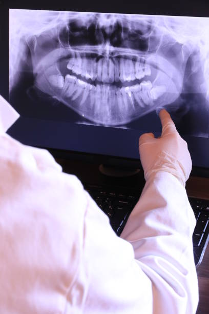 Best Knocked-Out Tooth Emergency  in Lake City, MN